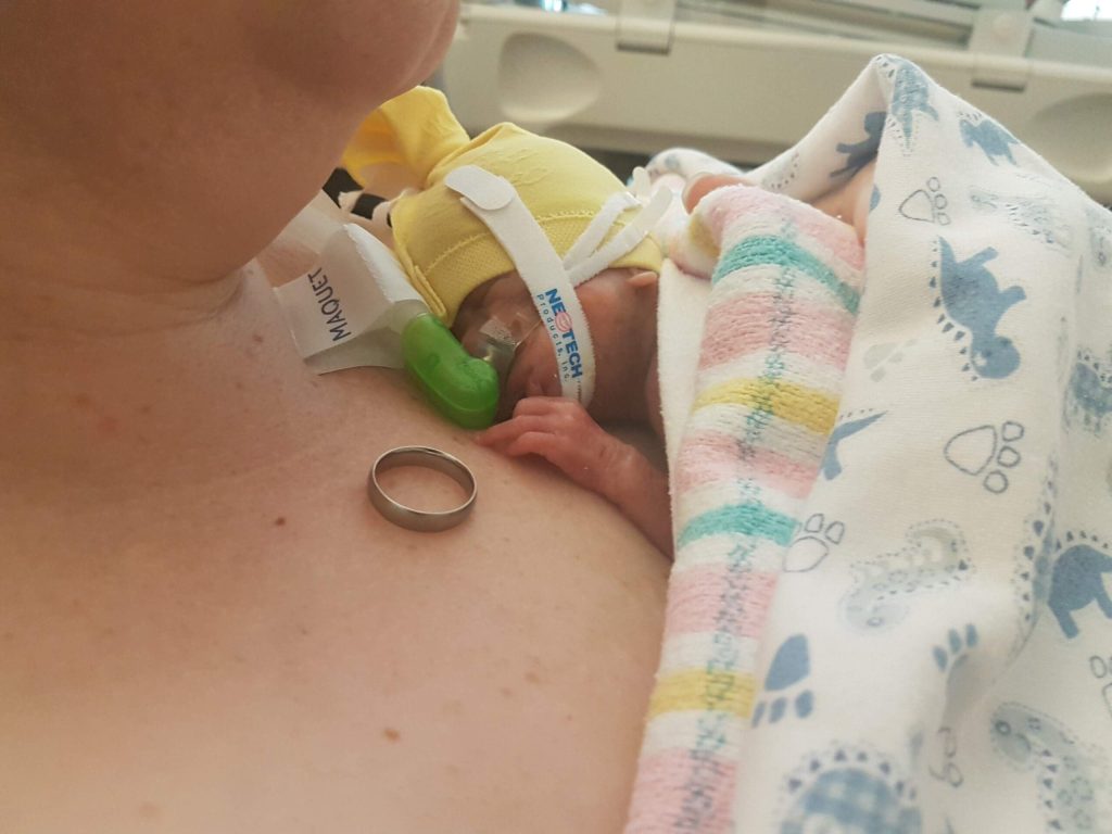 World Cerebral Palsy Day- Ashlee’s Story
